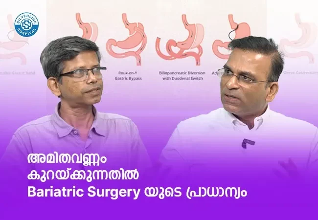 അമിതവണ്ണം കുറയ്ക്കുന്നതിൽ Bariatric Surgery യുടെ പ്രാധാന്യം